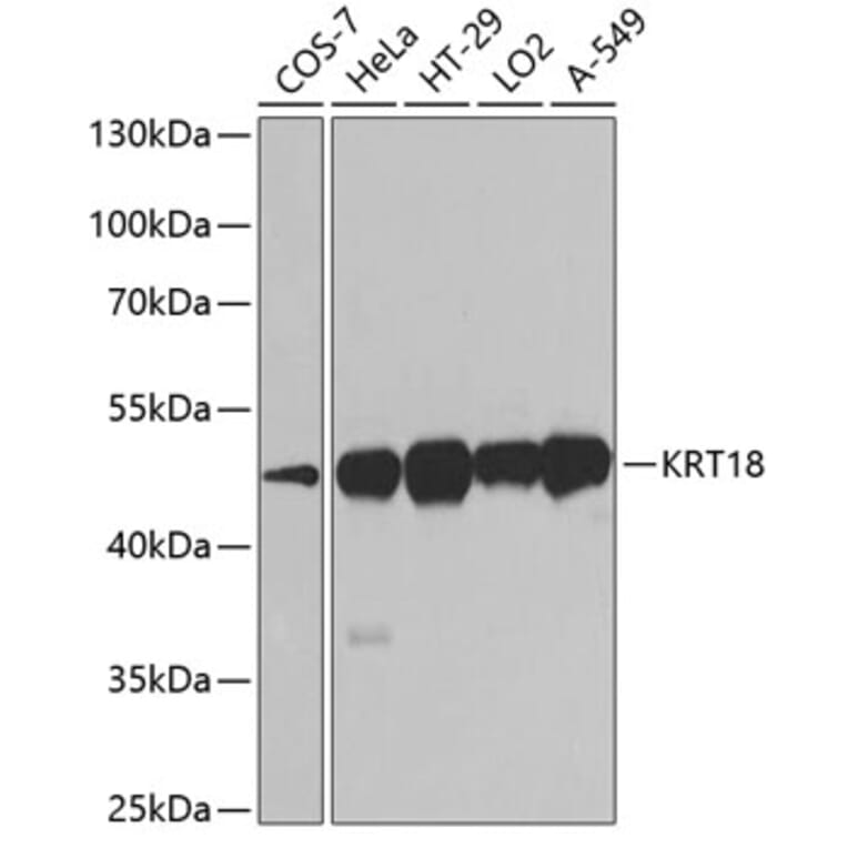 Western Blot - Anti-KRT18 Antibody (A0389) - Antibodies.com