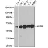 Western Blot - Anti-KRT18 Antibody (A0389) - Antibodies.com