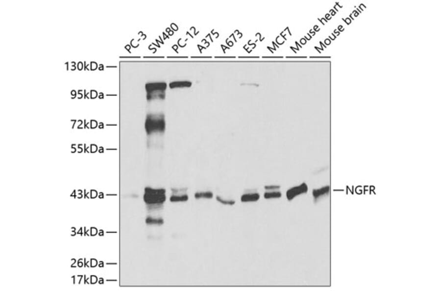 Western Blot - Anti-NGFR Antibody (A0418) - Antibodies.com