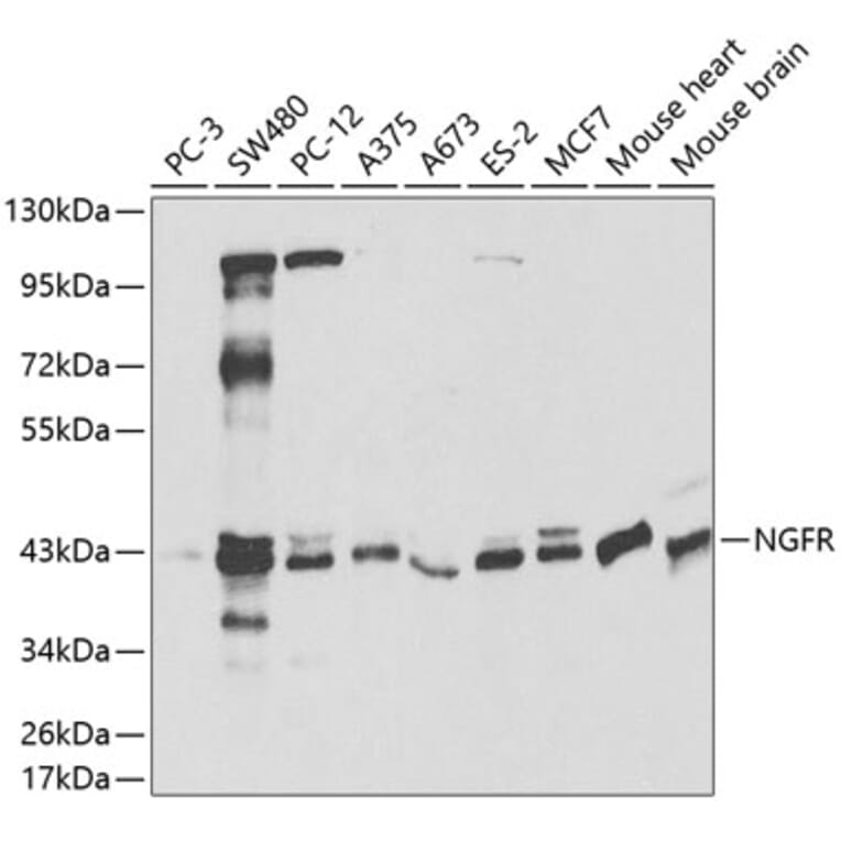 Western Blot - Anti-NGFR Antibody (A0418) - Antibodies.com