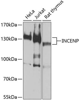 Western blot analysis of extracts of various cell lines, using Anti-INCENP Antibody (A0622) at 1:1,000 dilution.
Secondary antibody: Goat Anti-Rabbit IgG (H+L) (HRP) (AS014) at 1:10,000 dilution.
Lysates / proteins: 25µg per lane.
Blocking buffer: 3% non-fat dry milk in TBST.
Detection: ECL Basic Kit (RM00020).
Exposure time: 30s.