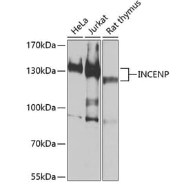 Western Blot - Anti-INCENP Antibody (A16779) - Antibodies.com