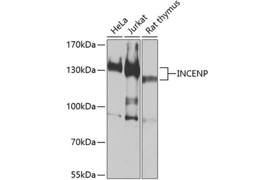 Western Blot - Anti-INCENP Antibody (A16779) - Antibodies.com