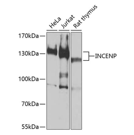 Western Blot - Anti-INCENP Antibody (A16779) - Antibodies.com