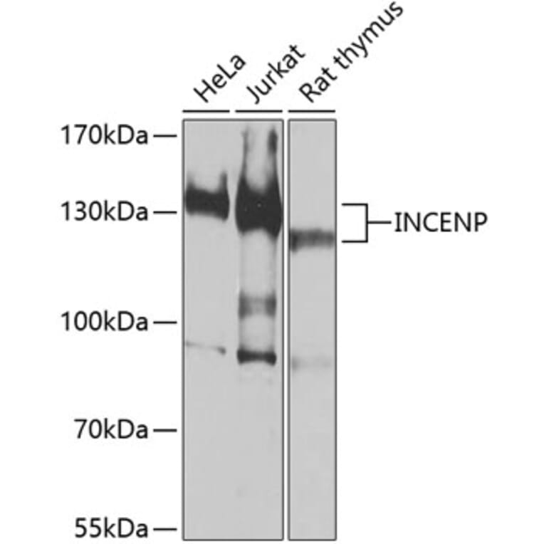 Western Blot - Anti-INCENP Antibody (A16779) - Antibodies.com