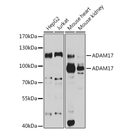 Western Blot - Anti-ADAM17 Antibody (A16782) - Antibodies.com