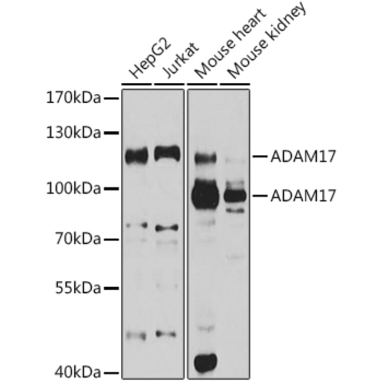 Western Blot - Anti-ADAM17 Antibody (A16782) - Antibodies.com