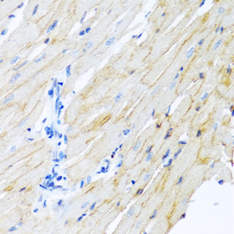 Immunohistochemistry - Anti-ADAM17 Antibody (A16782) - Antibodies.com