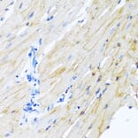 Immunohistochemistry - Anti-ADAM17 Antibody (A16782) - Antibodies.com