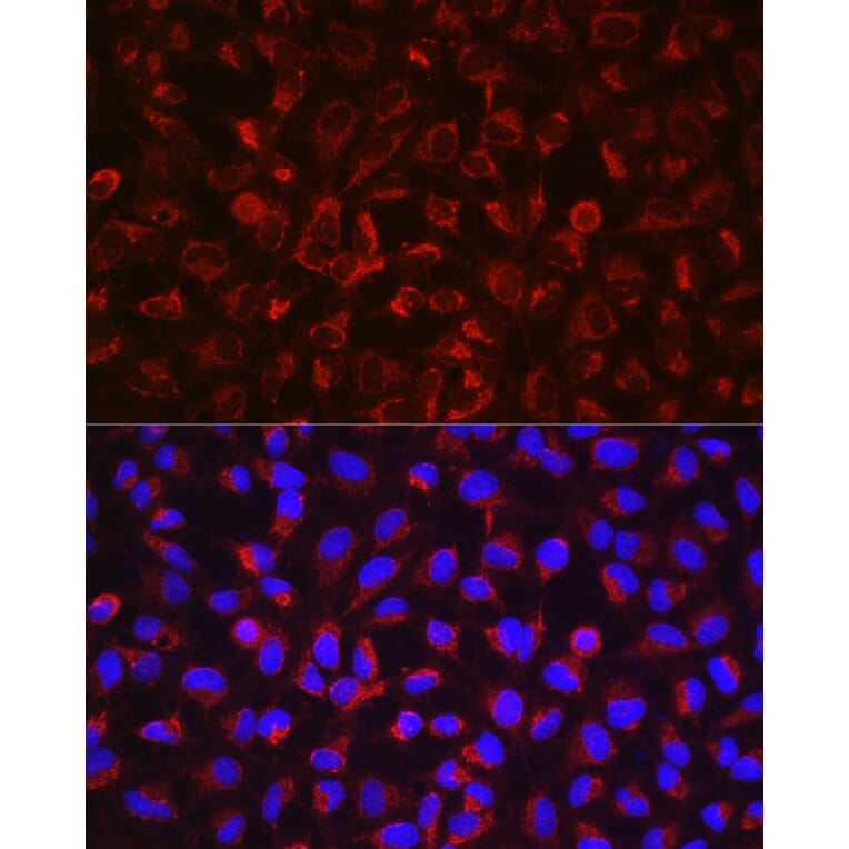 Immunofluorescence - Anti-ADAM17 Antibody (A16782) - Antibodies.com