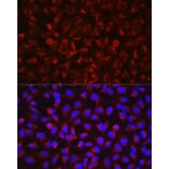 Immunofluorescence - Anti-ADAM17 Antibody (A16782) - Antibodies.com