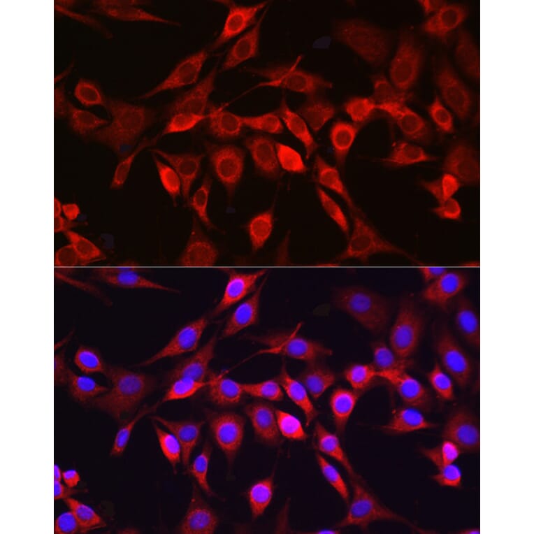 Immunofluorescence - Anti-ADAM17 Antibody (A16782) - Antibodies.com