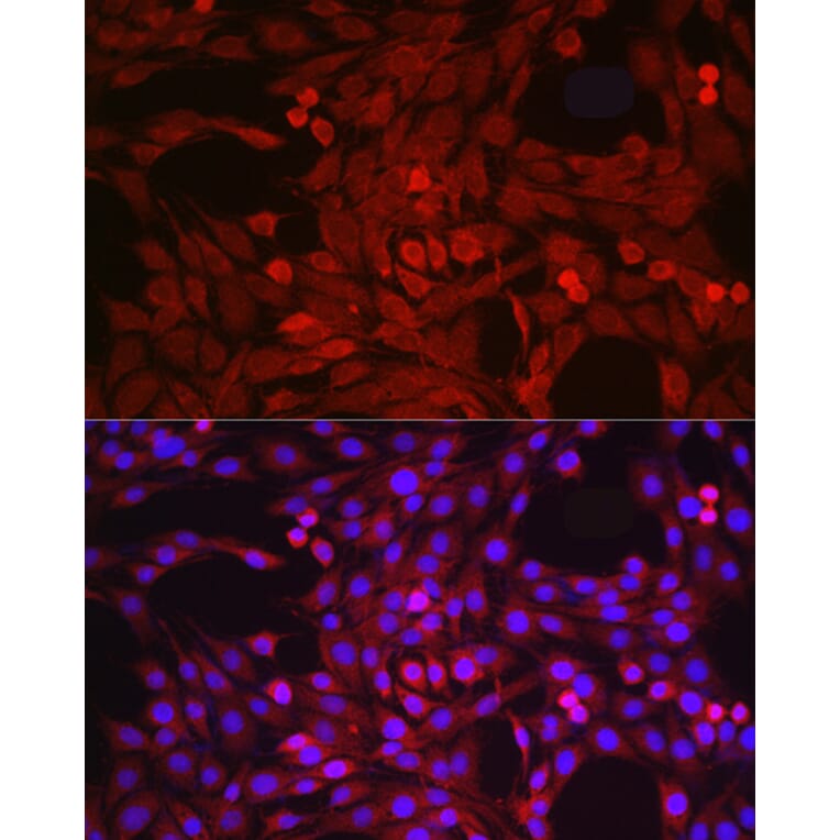 Immunofluorescence - Anti-ADAM17 Antibody (A16782) - Antibodies.com