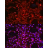 Immunofluorescence - Anti-ADAM17 Antibody (A16782) - Antibodies.com