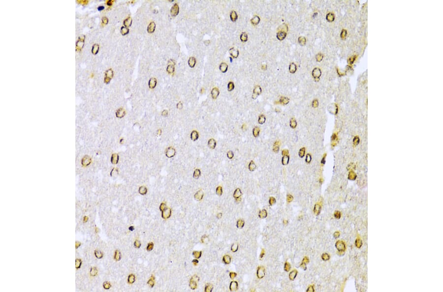 Immunohistochemistry - Anti-Ku70 Antibody (A16783) - Antibodies.com