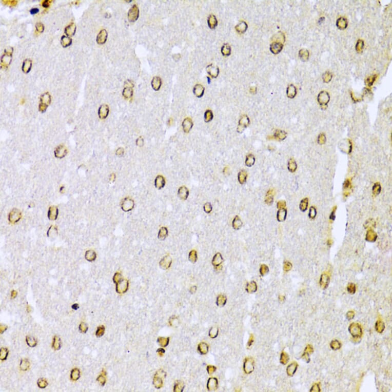Immunohistochemistry - Anti-Ku70 Antibody (A16783) - Antibodies.com