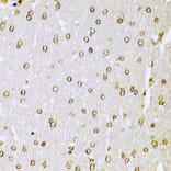 Immunohistochemistry - Anti-Ku70 Antibody (A16783) - Antibodies.com