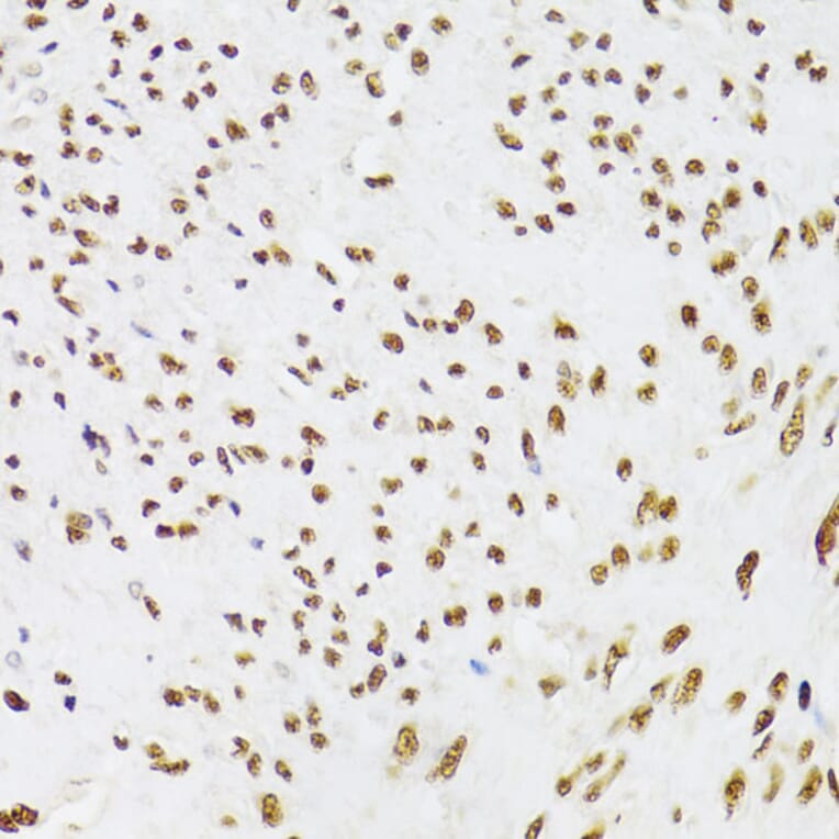 Immunohistochemistry - Anti-Ku70 Antibody (A16783) - Antibodies.com