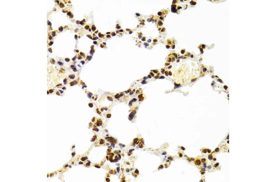 Immunohistochemistry - Anti-Ku70 Antibody (A16783) - Antibodies.com
