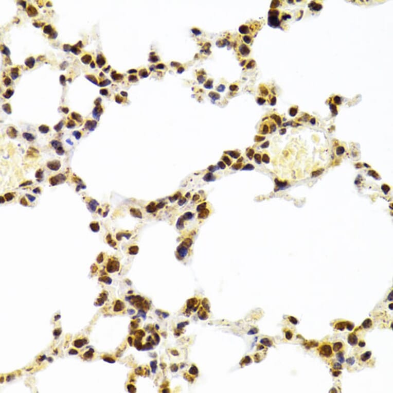 Immunohistochemistry - Anti-Ku70 Antibody (A16783) - Antibodies.com