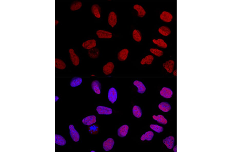 Immunofluorescence - Anti-Ku70 Antibody (A16783) - Antibodies.com