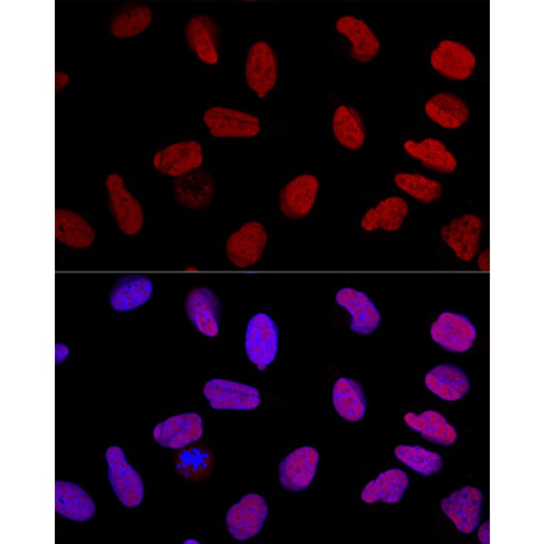 Immunofluorescence - Anti-Ku70 Antibody (A16783) - Antibodies.com