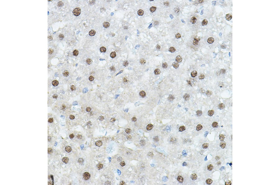 Immunohistochemistry - Anti-CEBP Alpha/CEBPA Antibody (A16784) - Antibodies.com