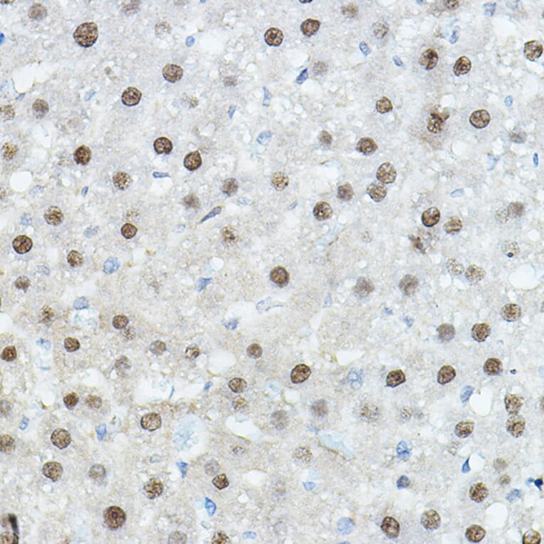 Immunohistochemistry - Anti-CEBP Alpha/CEBPA Antibody (A16784) - Antibodies.com