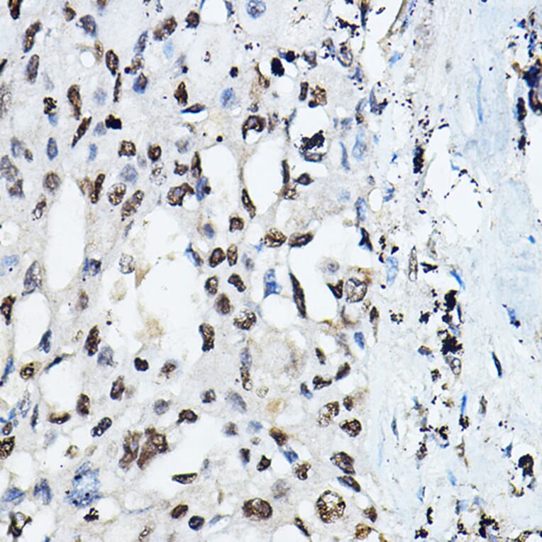 Immunohistochemistry - Anti-CEBP Alpha/CEBPA Antibody (A16784) - Antibodies.com