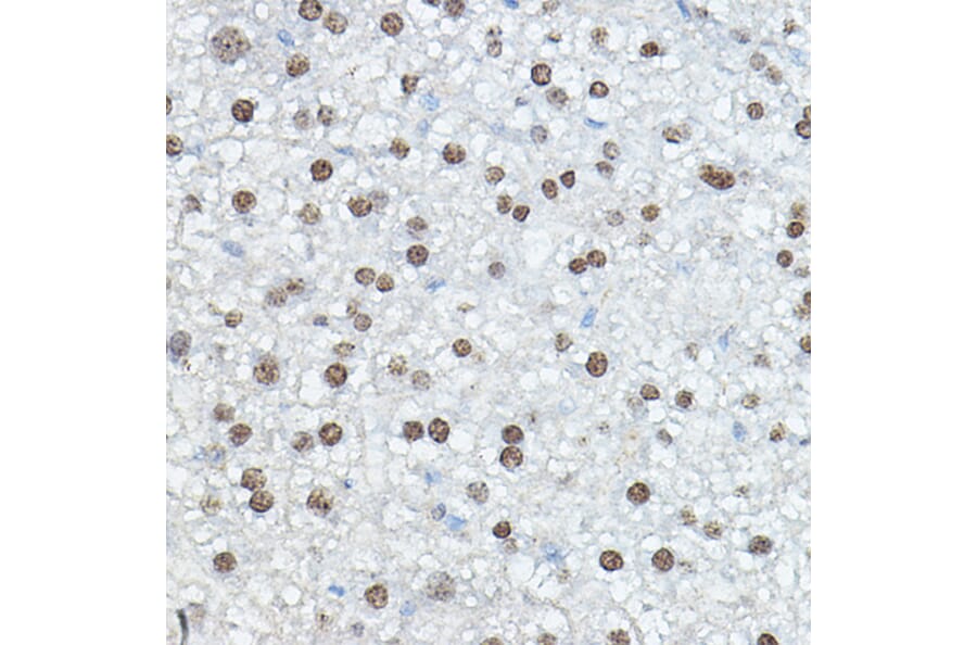 Immunohistochemistry - Anti-CEBP Alpha/CEBPA Antibody (A16784) - Antibodies.com