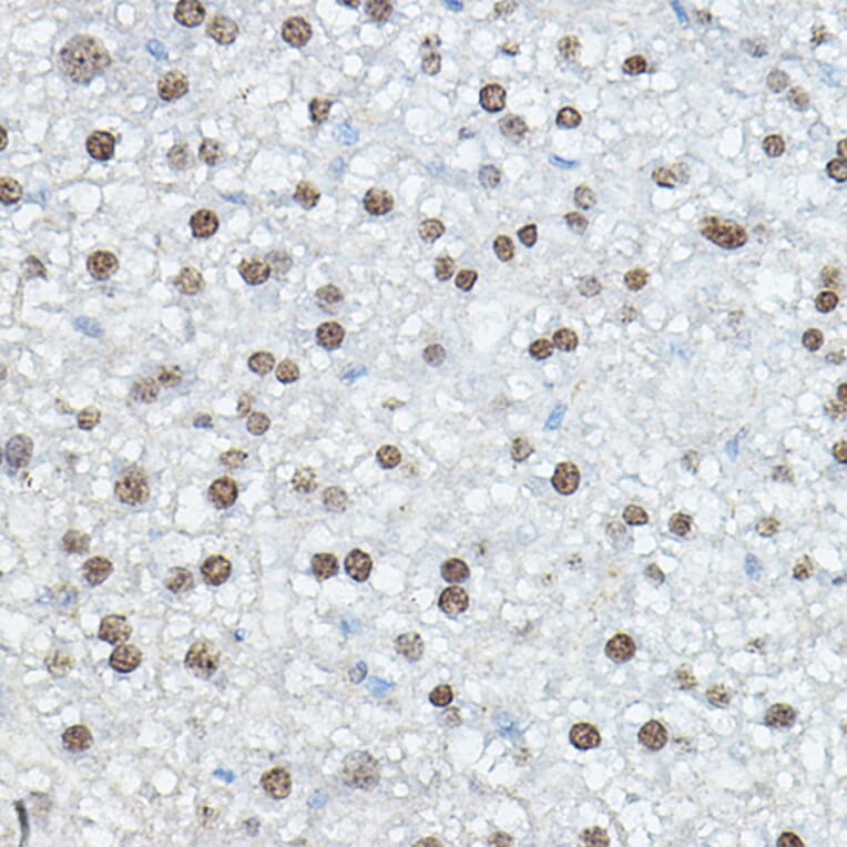 Immunohistochemistry - Anti-CEBP Alpha/CEBPA Antibody (A16784) - Antibodies.com