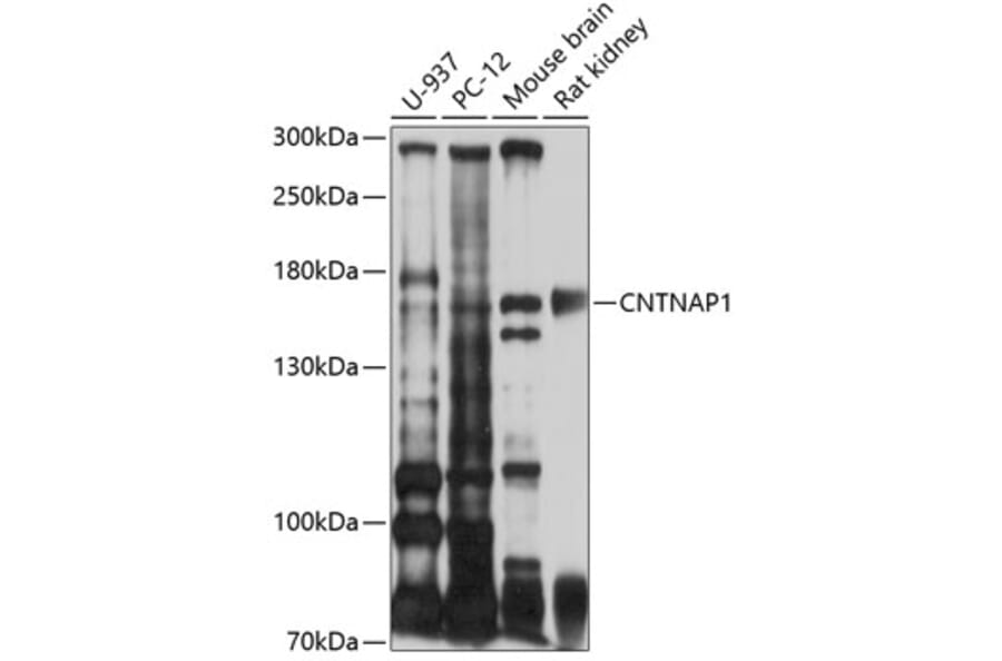 Western Blot - Anti-CNTNAP1 Antibody (A10058) - Antibodies.com