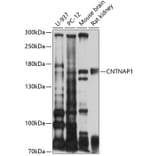 Western Blot - Anti-CNTNAP1 Antibody (A10058) - Antibodies.com