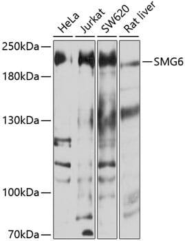 Western blot analysis of extracts of various cell lines, using Anti-SMG6 Antibody (A10141) at 1:1,000 dilution.
Secondary antibody: Goat Anti-Rabbit IgG (H+L) (HRP) (AS014) at 1:10,000 dilution.
Lysates / proteins: 25µg per lane.
Blocking buffer: 3% non-fat dry milk in TBST.
Detection: ECL Basic Kit (RM00020).
Exposure time: 30s.