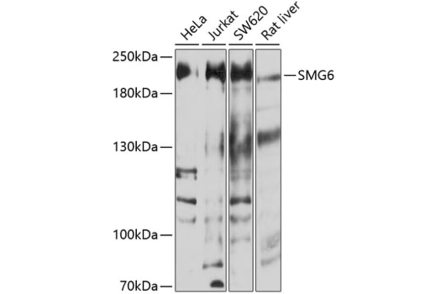 Western Blot - Anti-SMG6 Antibody (A16786) - Antibodies.com