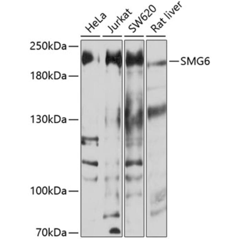 Western Blot - Anti-SMG6 Antibody (A16786) - Antibodies.com