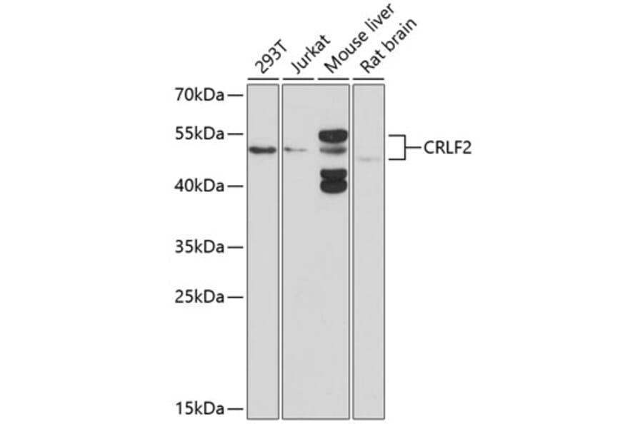 Western Blot - Anti-CRLF2 Antibody (A16787) - Antibodies.com