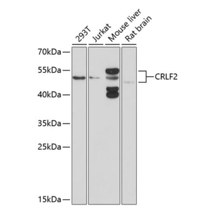 Western Blot - Anti-CRLF2 Antibody (A16787) - Antibodies.com