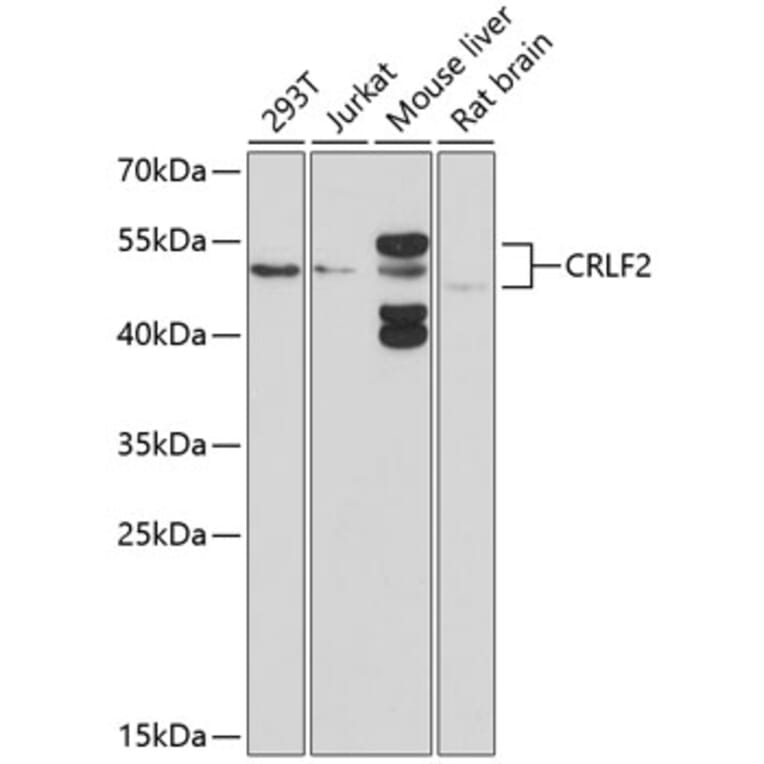 Western Blot - Anti-CRLF2 Antibody (A16787) - Antibodies.com
