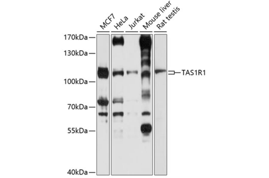 Western Blot - Anti-TR1 Antibody (A16788) - Antibodies.com
