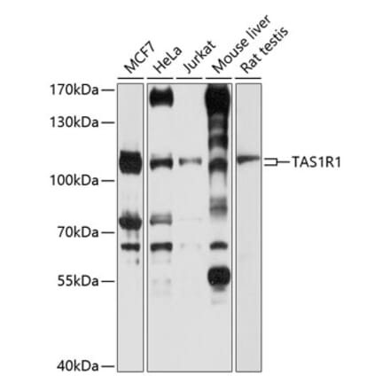 Western Blot - Anti-TR1 Antibody (A16788) - Antibodies.com