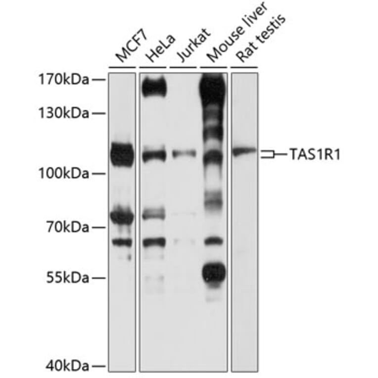 Western Blot - Anti-TR1 Antibody (A16788) - Antibodies.com