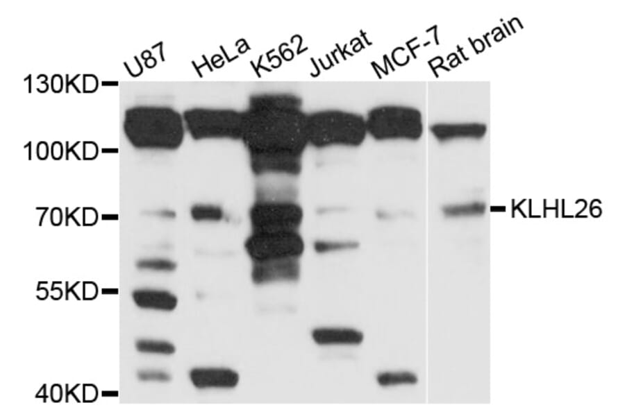 Western Blot - Anti-KLHL26 Antibody (A10374) - Antibodies.com