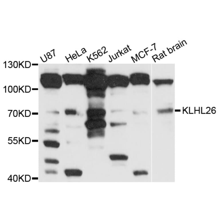 Western Blot - Anti-KLHL26 Antibody (A10374) - Antibodies.com