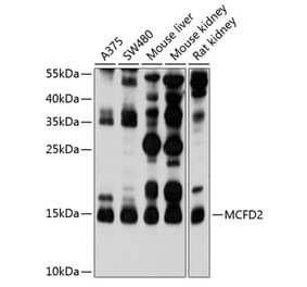 Western Blot - Anti-MCFD2 Antibody (A16791) - Antibodies.com