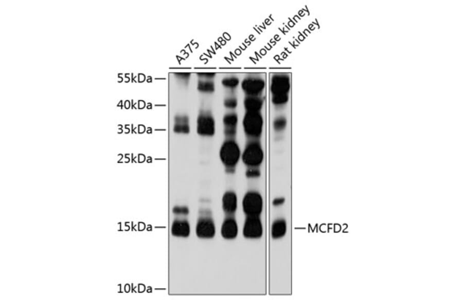 Western Blot - Anti-MCFD2 Antibody (A16791) - Antibodies.com