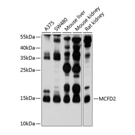 Western Blot - Anti-MCFD2 Antibody (A16791) - Antibodies.com