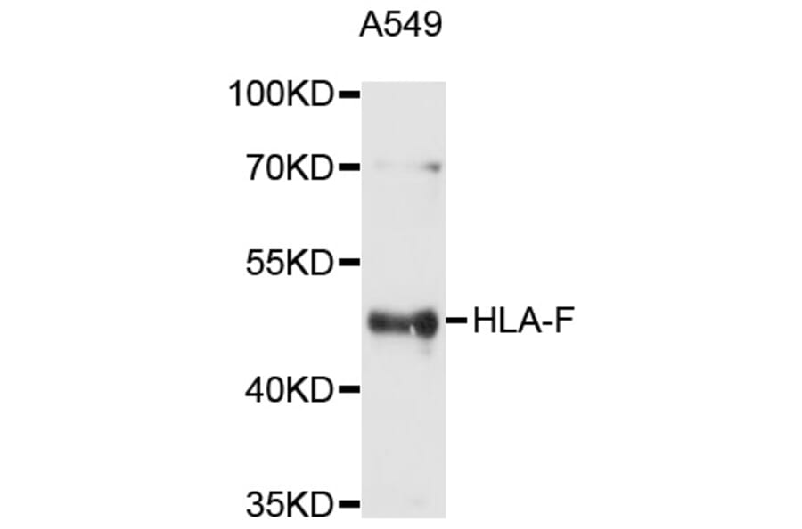Western Blot - Anti-HLA-F Antibody (A10384) - Antibodies.com