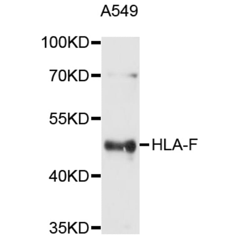 Western Blot - Anti-HLA-F Antibody (A10384) - Antibodies.com