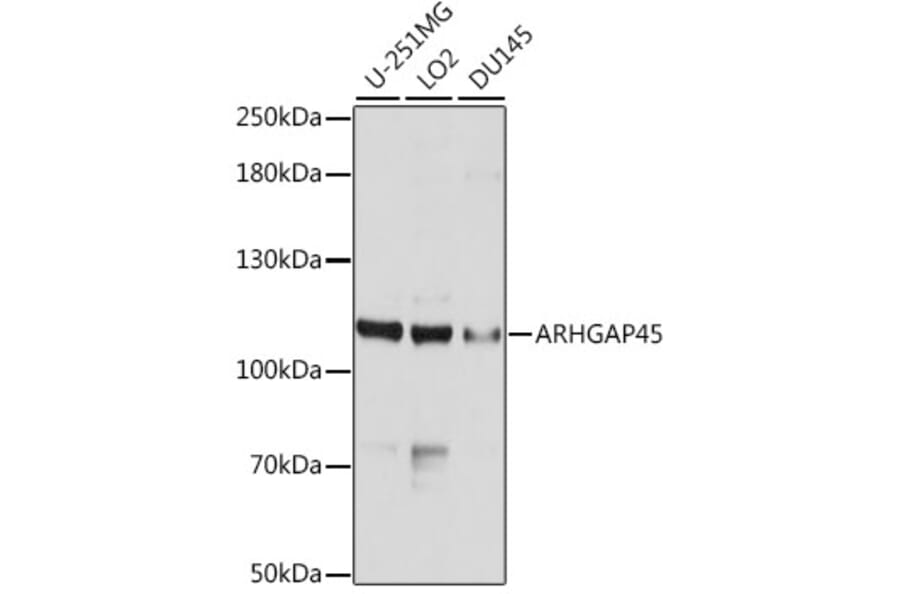 Western Blot - Anti-ARHGAP45 Antibody (A10454) - Antibodies.com